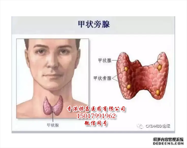 甲状旁腺激素Natpara